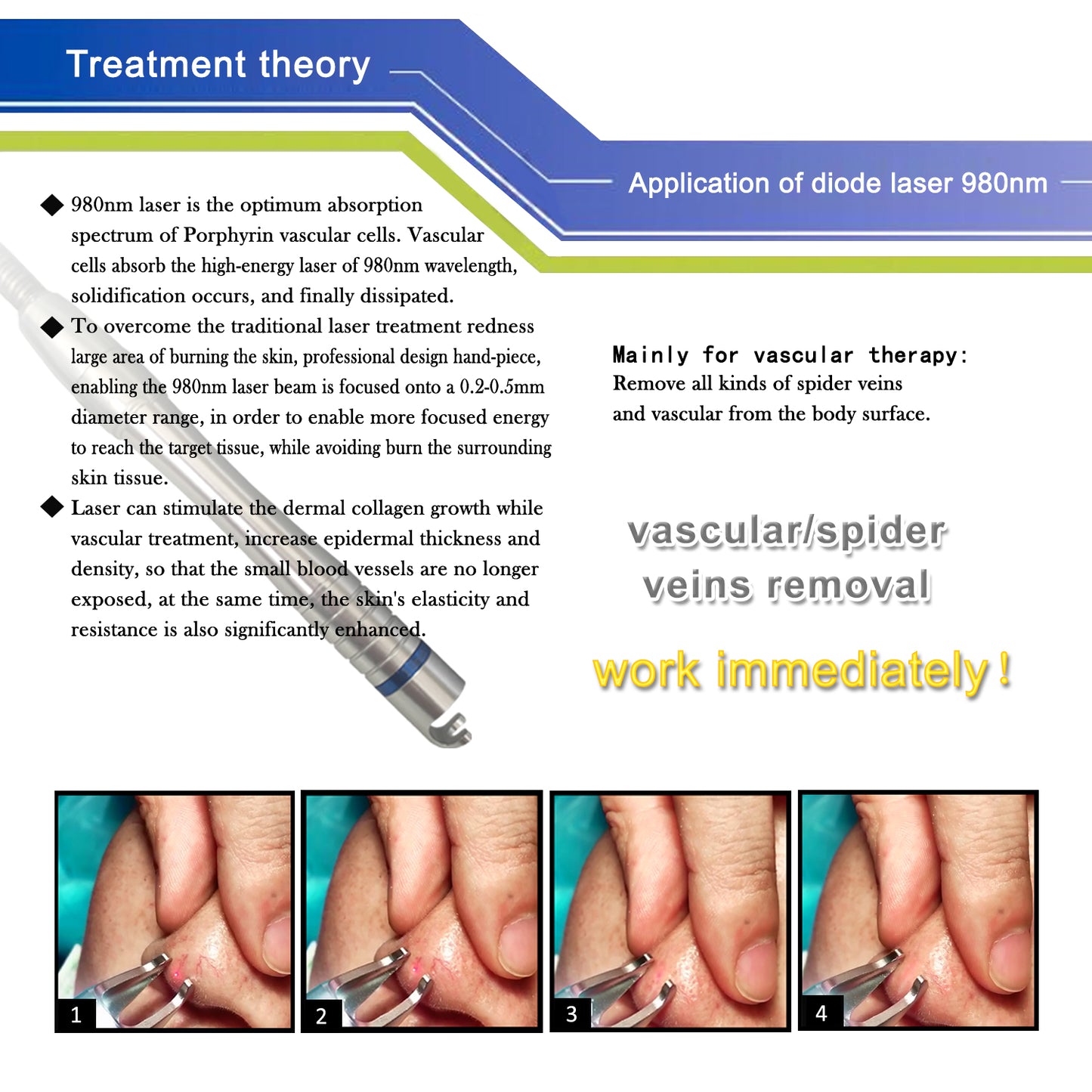 980nm laser vascular removal veins therapy machine