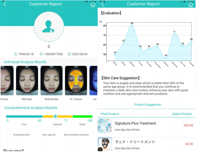 Skin analyzer machine for beauty salon