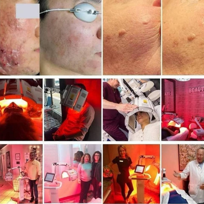 PDT LED Light therapy skin whitening acne therapy facial care machine