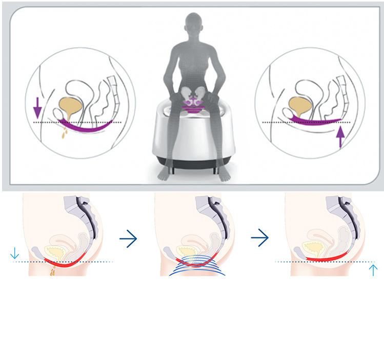 vertical ems muscle care machine with pelvic handle/pelvic seat cushion